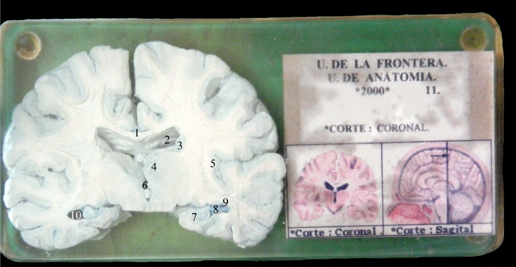 Atlas De Configuraci N Interna De Cerebro Neuroanatom A Ufro